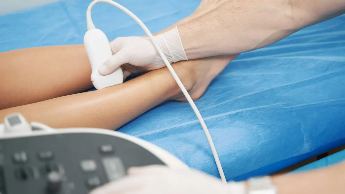 Doppler arti inferiori